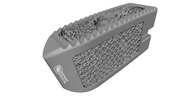 Imprint Medical Enhances Lattice Based Implant Design With 3dxpert For Solidworks 3d Science Valley